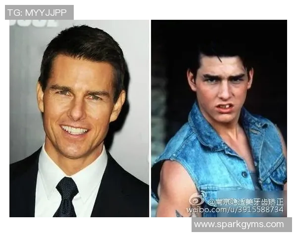 足球明星整牙背后的故事与改变人生的微笑之旅